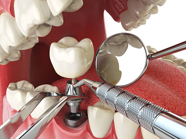 Emergency Gum Pain Relief in MD